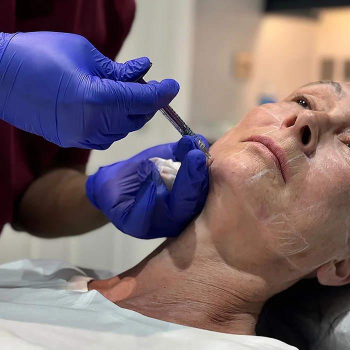 Doctor-led anti-ageing treatment at Rejuvena Clinic, Bedford — clinician injecting along the jawline