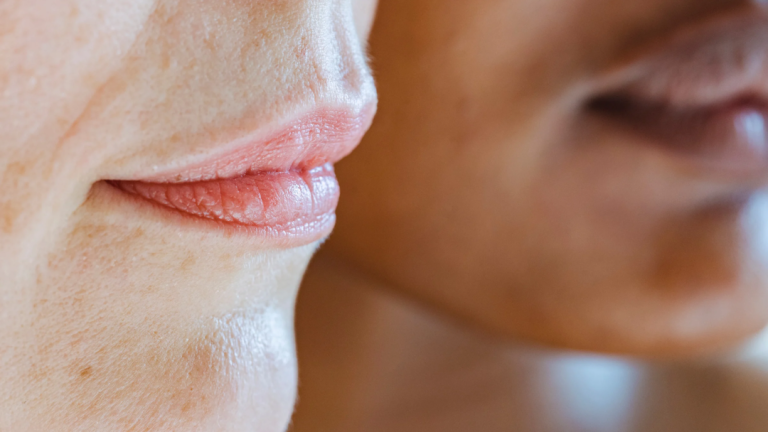 pigmentation treatments