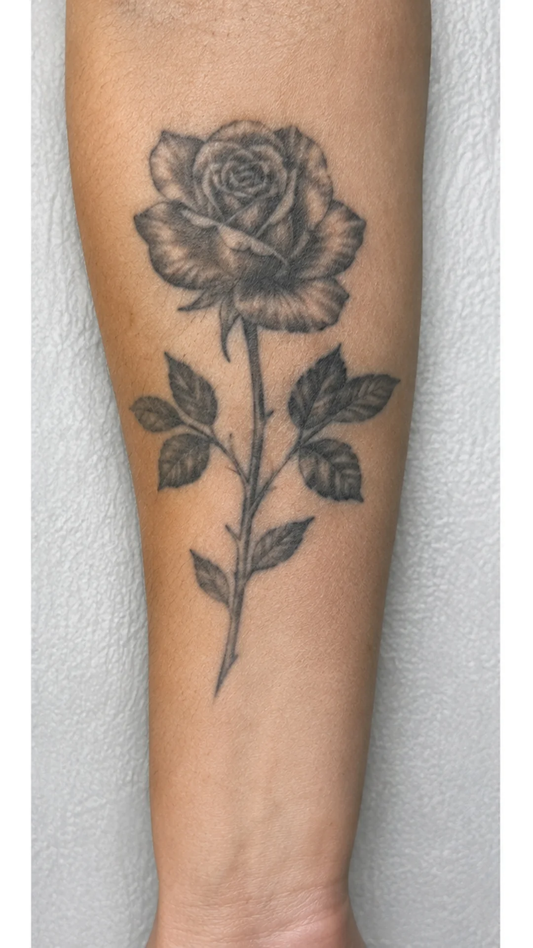 Tattoo Removal before — Rejuvena Clinic Bedford