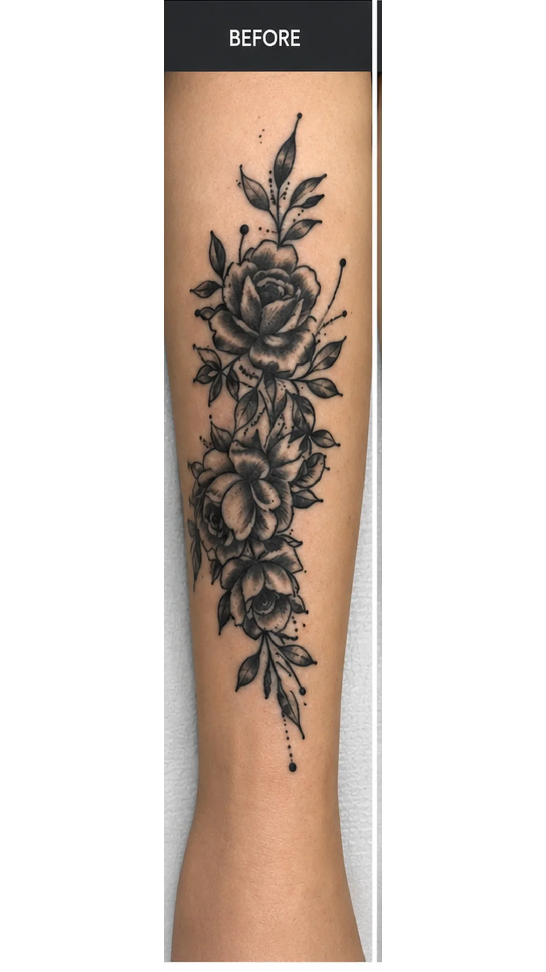 Tattoo Removal (3 sessions) before — Rejuvena Clinic Bedford