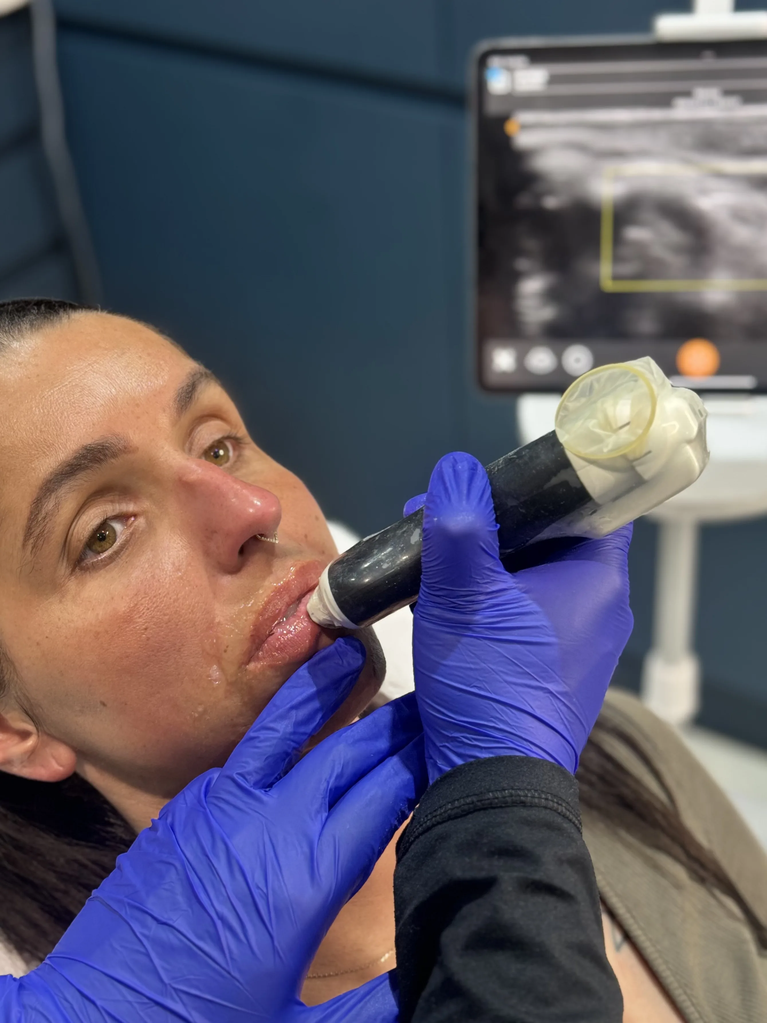 Doctor-led Clarius aesthetic ultrasound assessment in progress at Rejuvena Clinic, Bedford