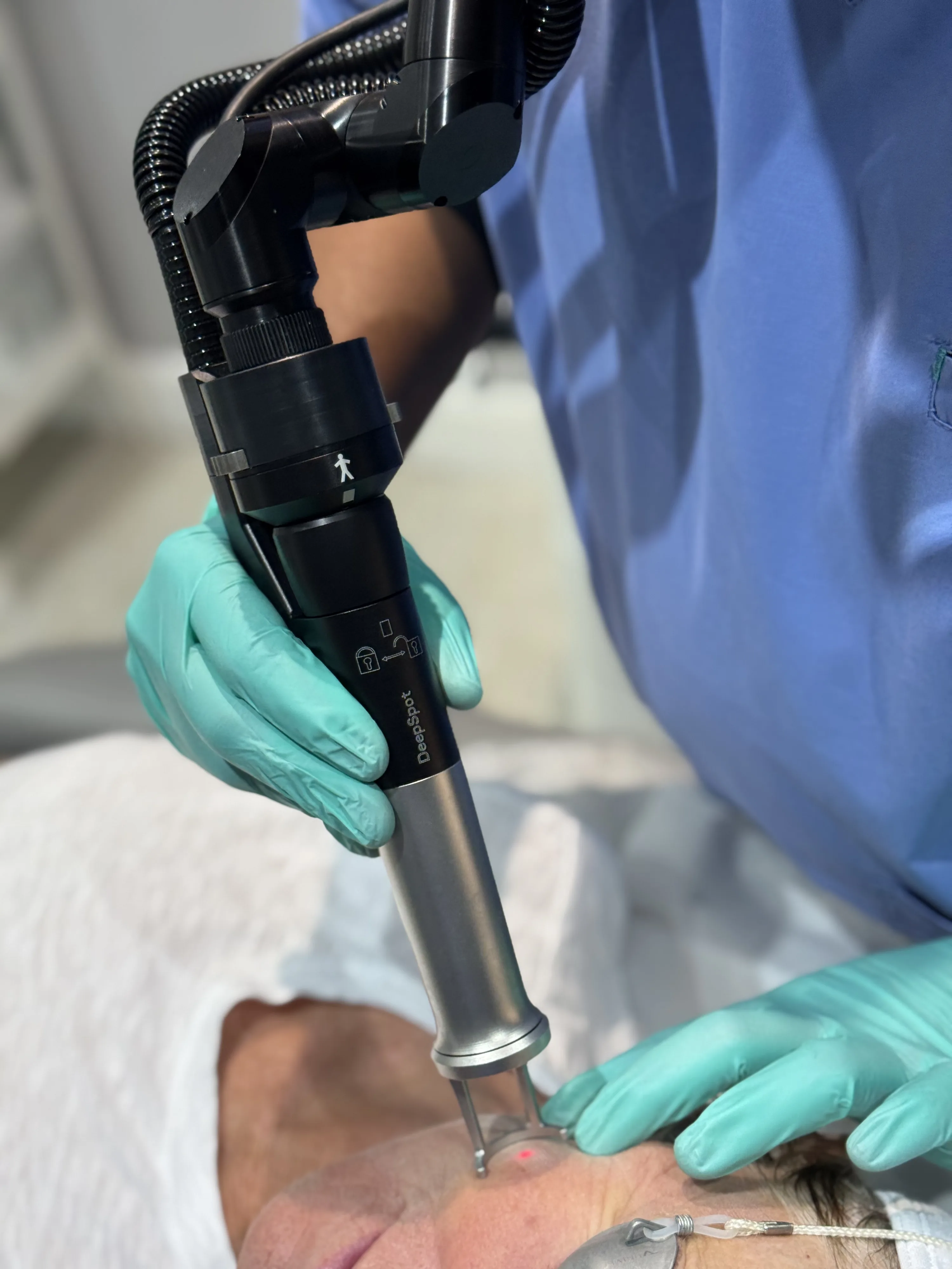Clinician performing laser scar treatment at Rejuvena Laser & Aesthetic Clinic, Bedford