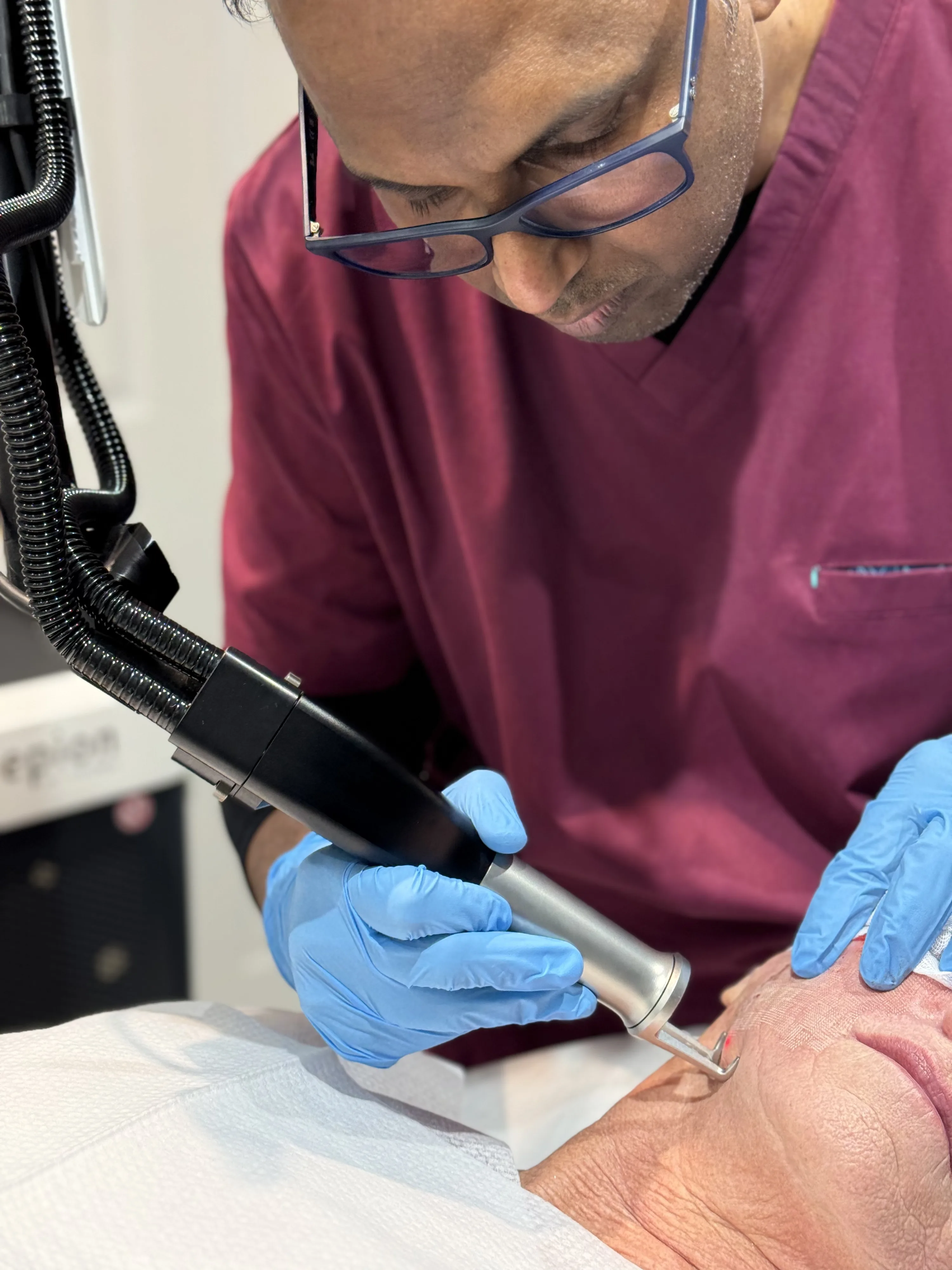Clinician performing Cool Laser skin resurfacing with a laser handpiece on a patient's face at Rejuvena Clinic, Bedford