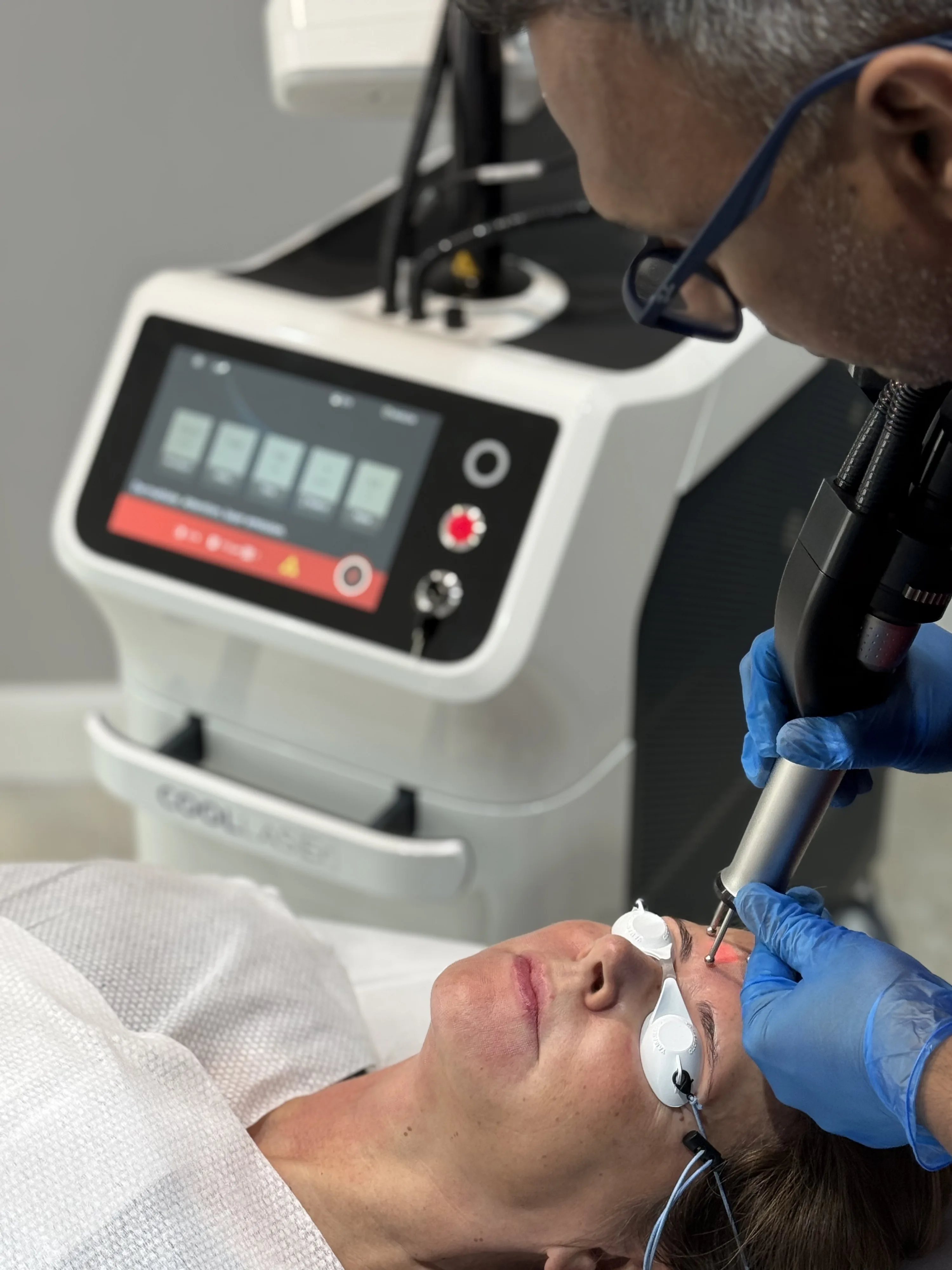 Clinician using the Dermablate Cool Laser handpiece near a patient's eye area during a Cool Bleph treatment at Rejuvena Clinic, Bedford