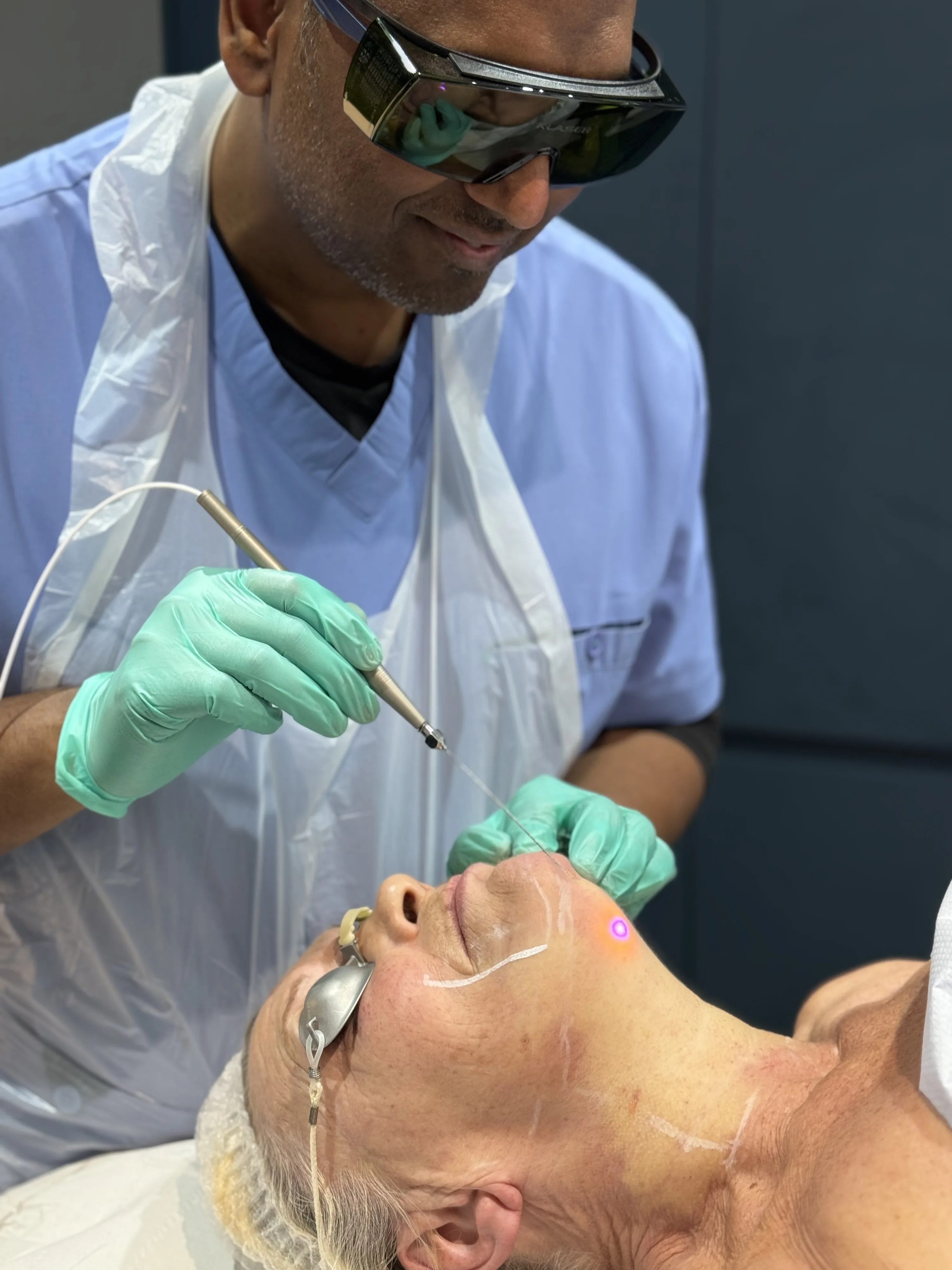 Doctor-led, non-surgical upper-arm skin tightening and contouring for bingo wings at Rejuvena Clinic, Bedford