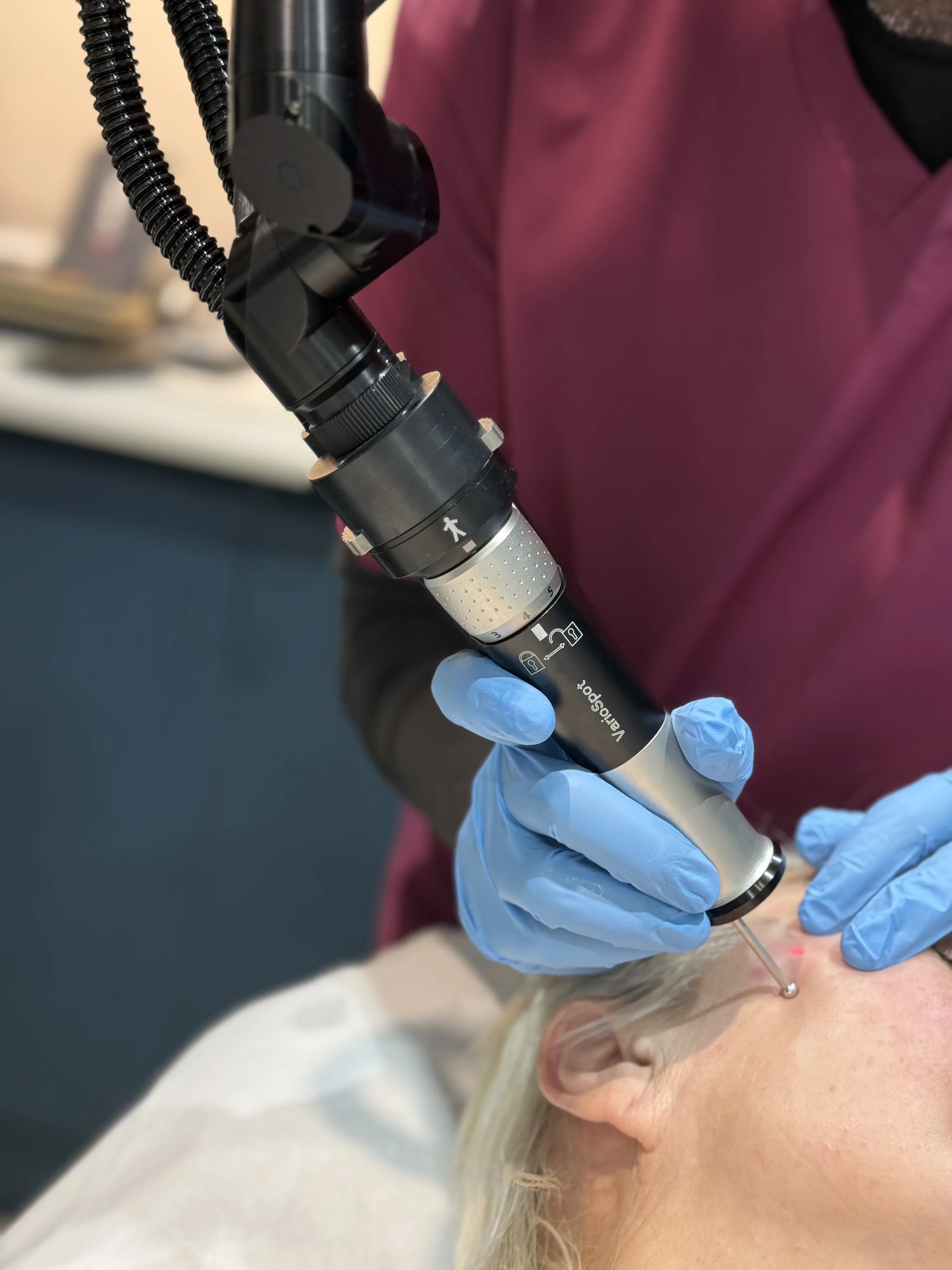 Doctor-led syringoma assessment and removal at Rejuvena Clinic, Bedford