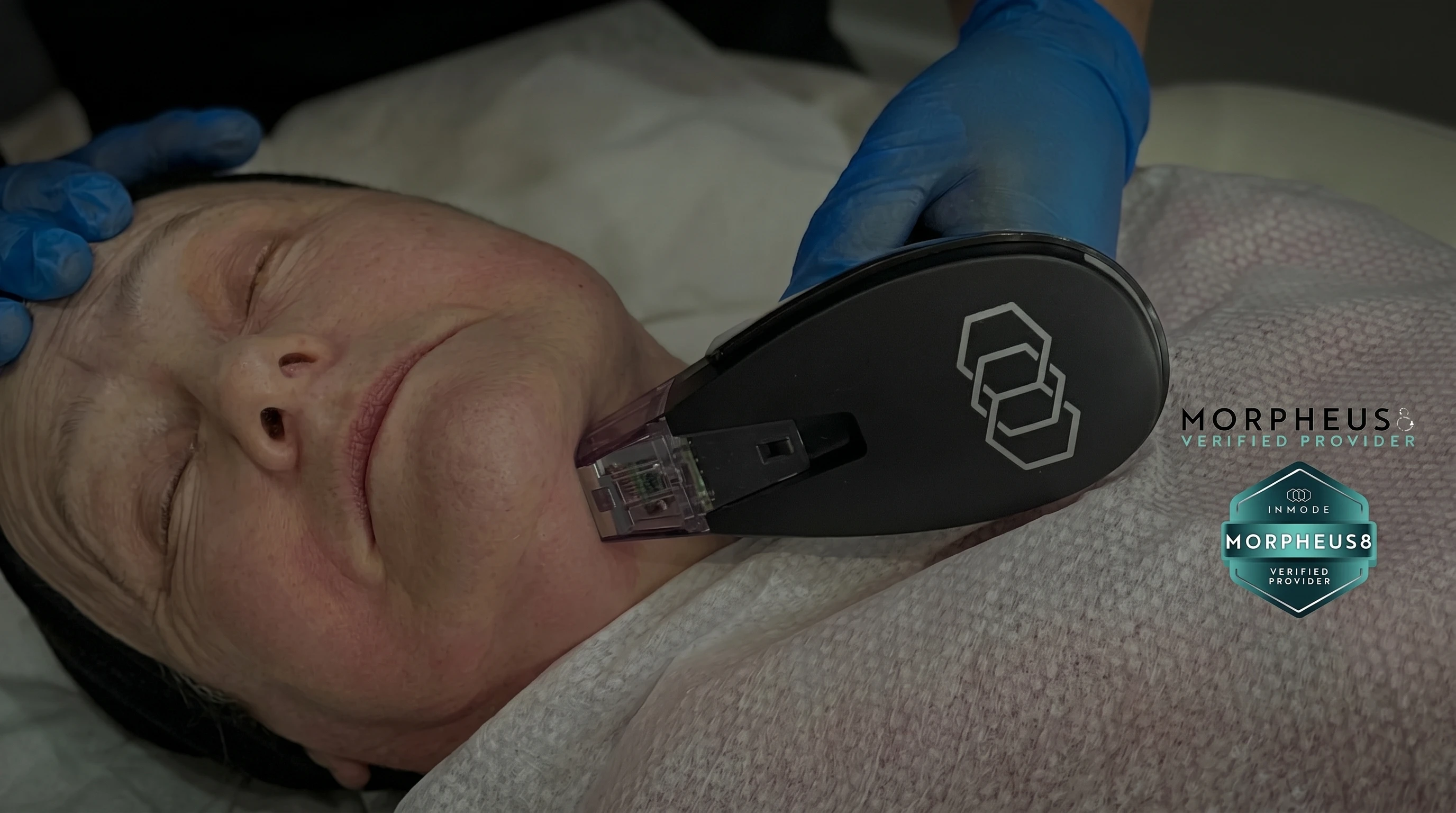 Dr Nick assessing the lower face and jawline for non-surgical jowls treatment during doctor-led care at Rejuvena Clinic, Bedford