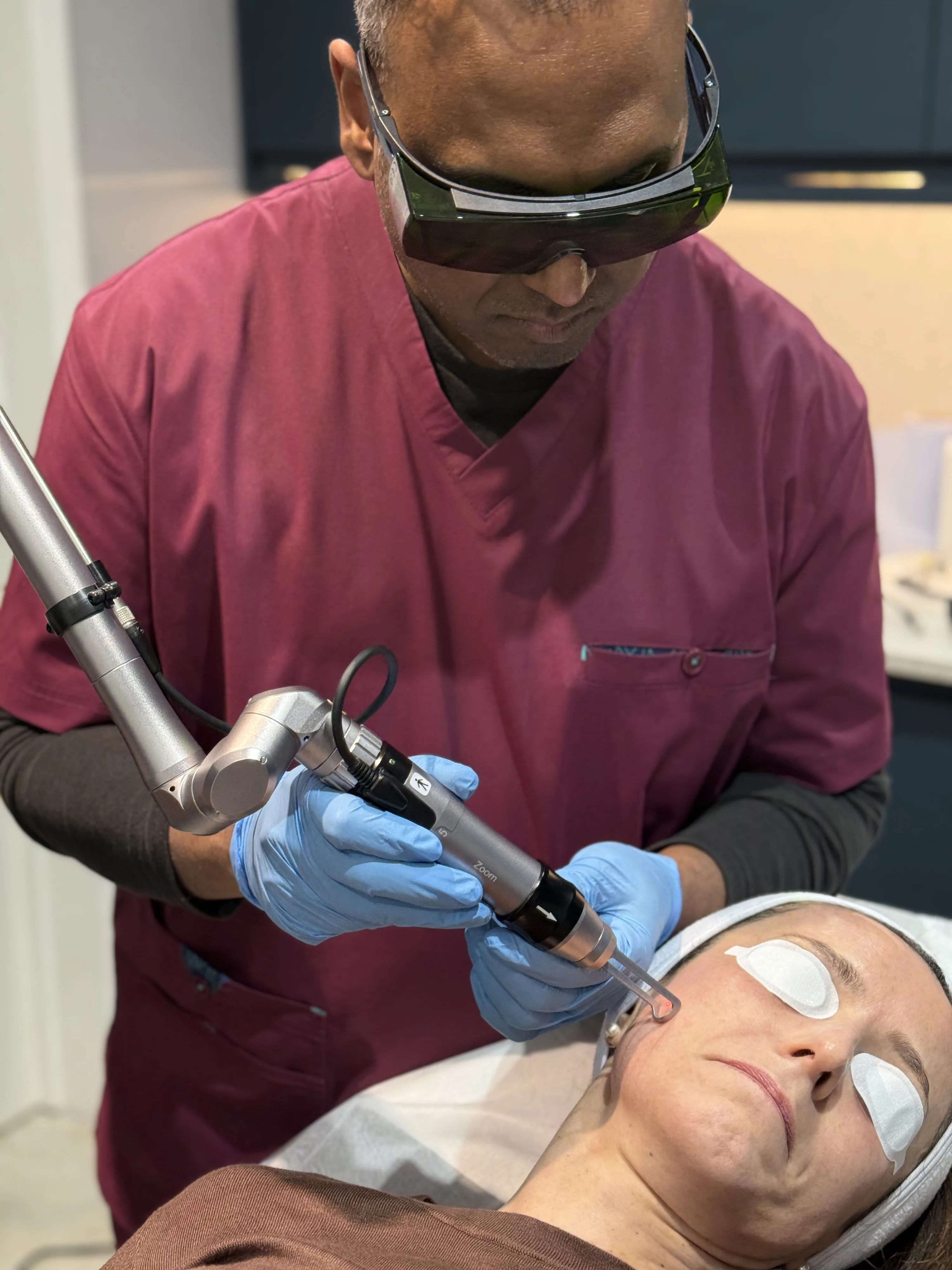 Clinician applying Lumecca IPL to lighten freckles during doctor-led skin treatment at Rejuvena Clinic, Bedford