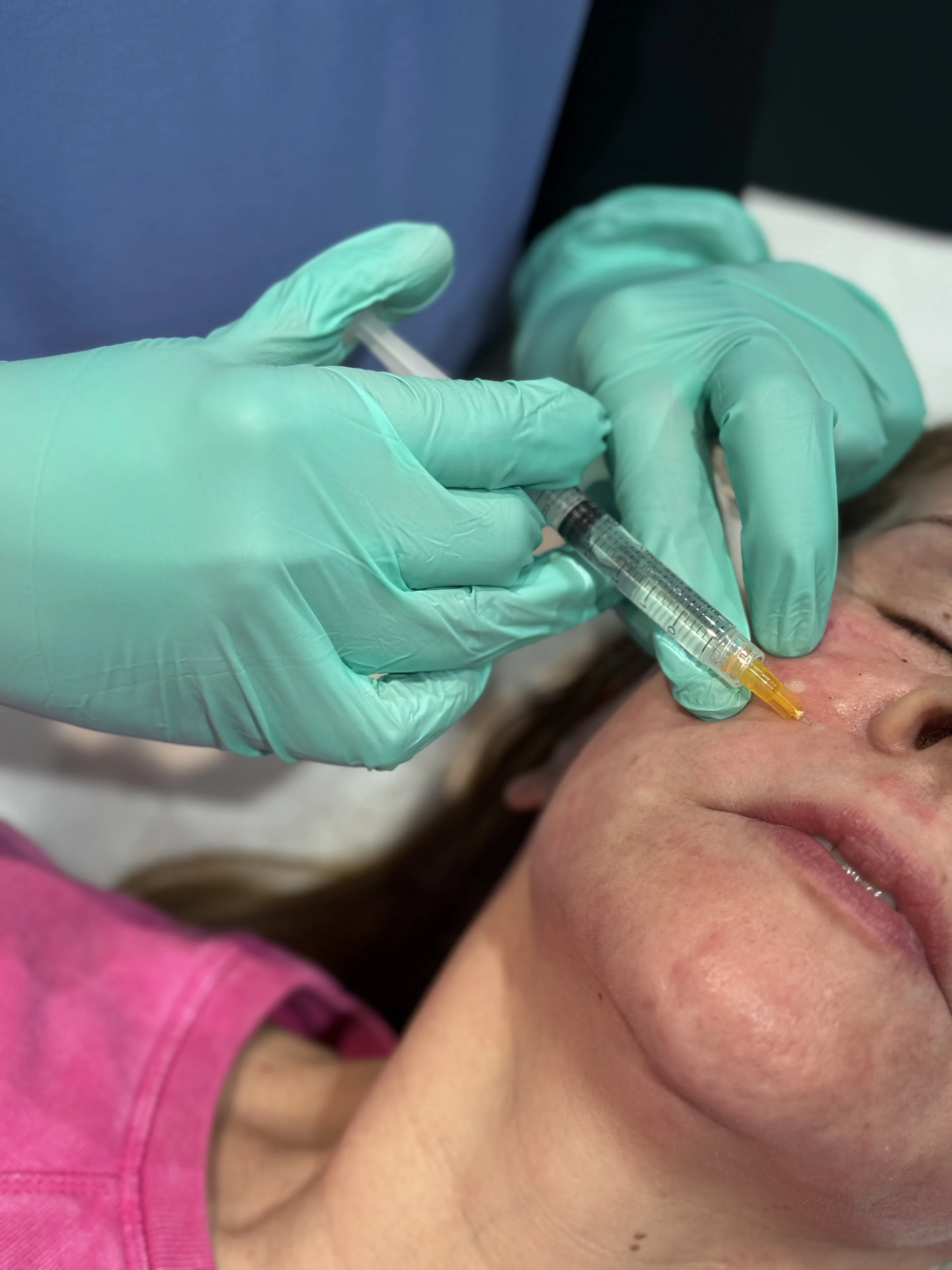 Dr Nick assessing a patient for regenerative skin rejuvenation at Rejuvena Clinic in Bedford