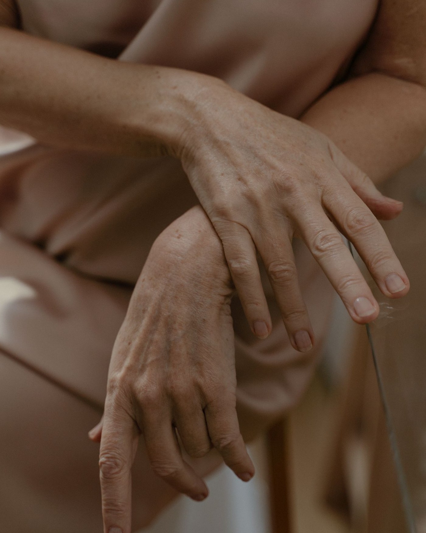 Close-up of flat brown solar lentigines (age spots) on the back of a mature hand — the discrete sun-damage pigmentation treated at Rejuvena Bedford