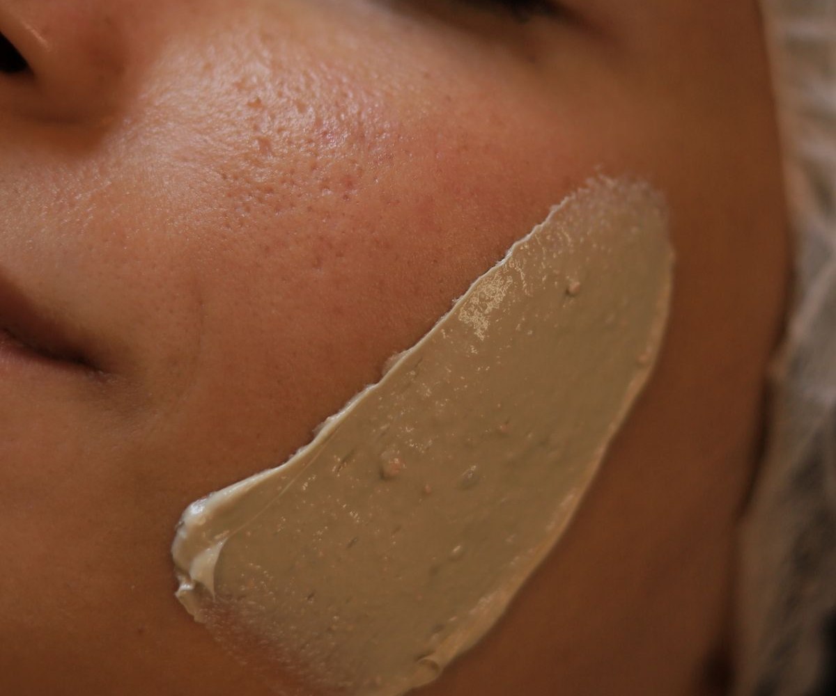 Depigmenting peel mask applied to the cheek during professional pigmentation treatment at Rejuvena Bedford