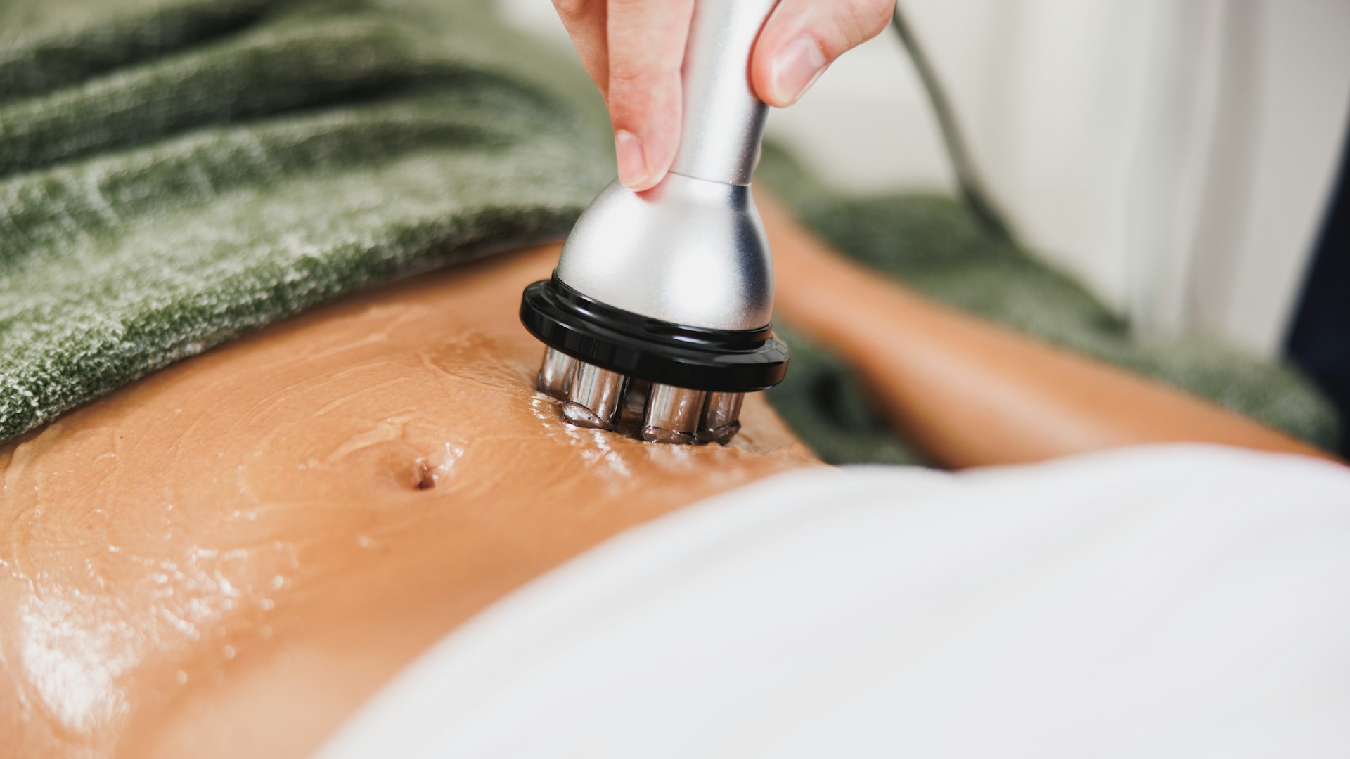 Radiofrequency body treatment being performed over an area of abdominal skin