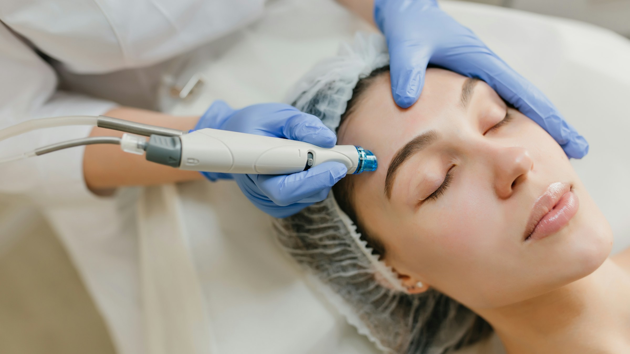 Doctor-led melasma assessment at Rejuvena Clinic, Bedford