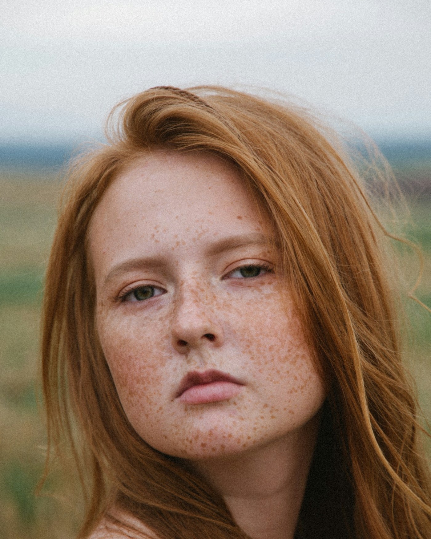 Close-up of natural light freckles (ephelides) across the cheeks and nose on fair skin — small, flat, tan-brown spots