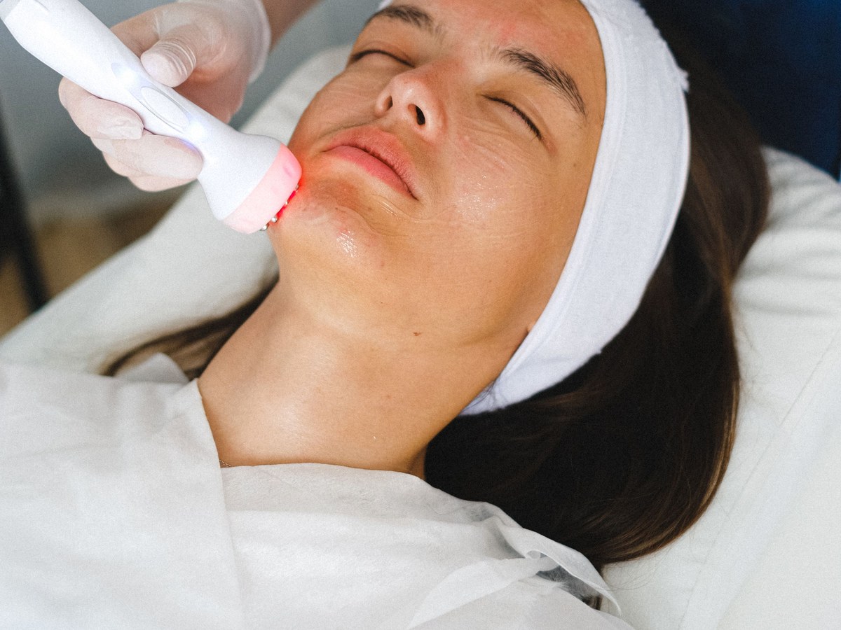 Light-based IPL handpiece applied to a patient's cheek during a pigment-lightening session, illustrative of freckle treatment in Bedford