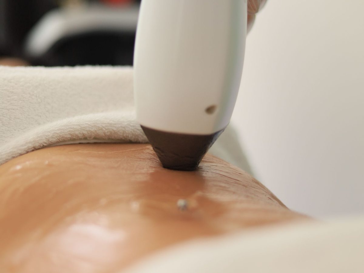 Illustrative stock photo of a laser toning handpiece in use in a clinic setting — pico laser pigment toning, Bedford