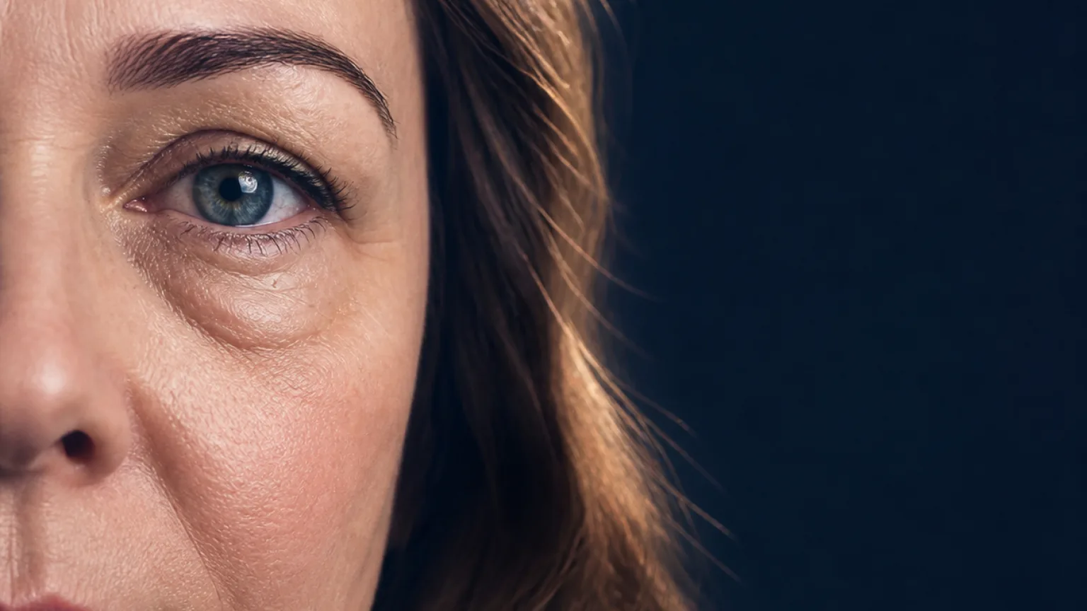 Natural eye area showing under-eye bags and puffiness