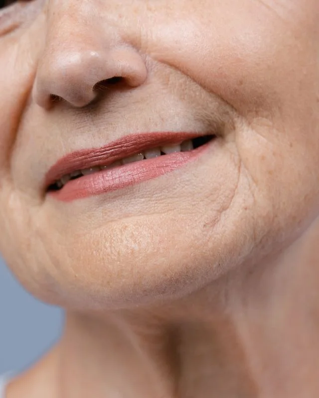 Natural image showing crepey skin