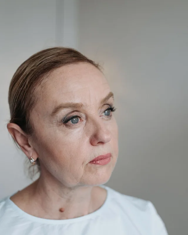 Natural image showing dull, tired skin