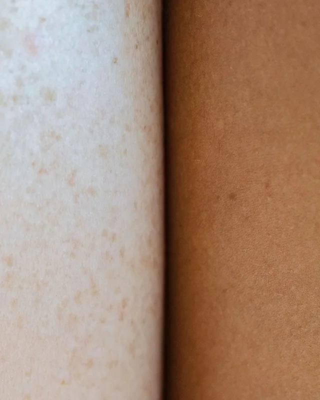 Natural image showing uneven tone & age spots