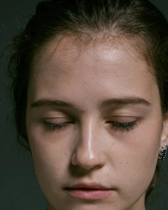 Natural image showing dull, tired skin