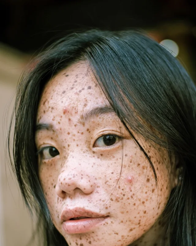 Natural image showing pigmentation