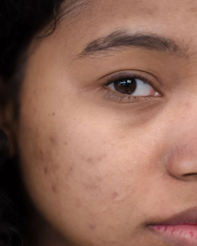 Natural image showing uneven texture