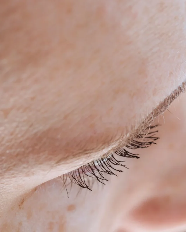 Natural image showing fine lines & wrinkles