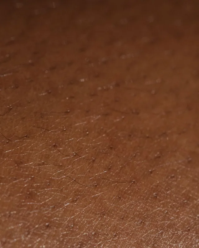 Natural image showing uneven texture
