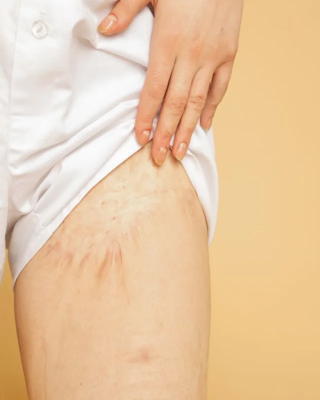 Natural image showing old, faded scars