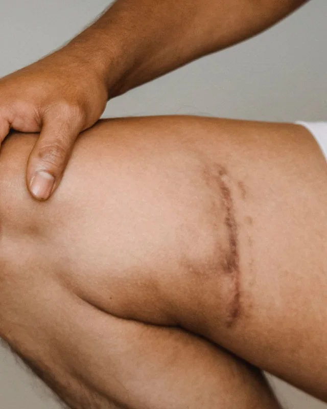 Natural image showing trauma & injury scars