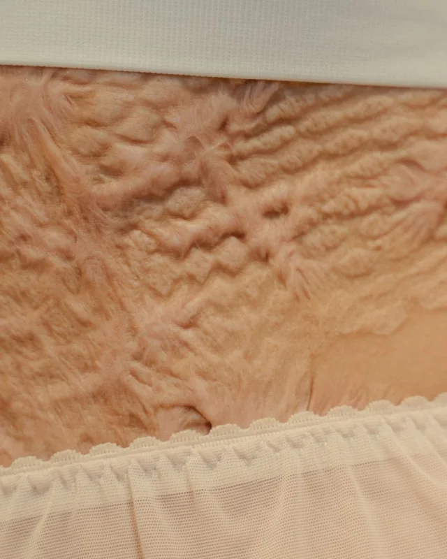 Natural image showing uneven scar texture