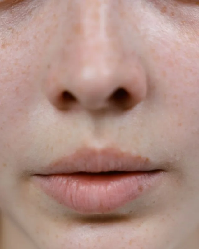 Natural close-up of facial freckles