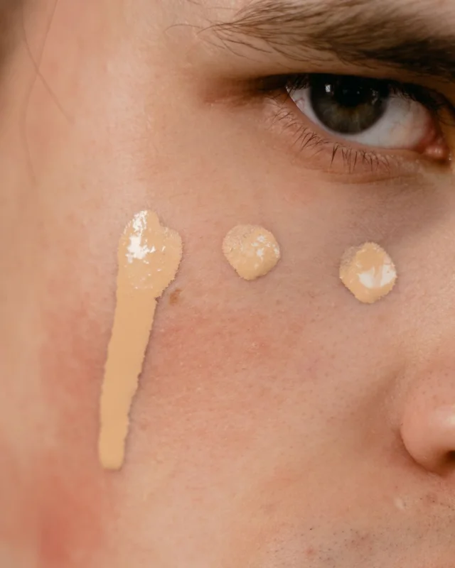 Natural facial complexion showing uneven skin tone