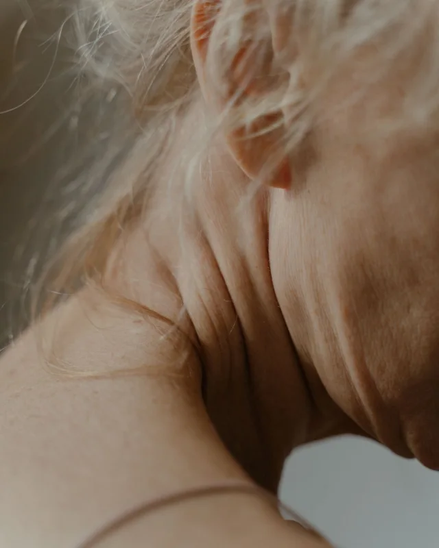 Natural image showing crepey neck