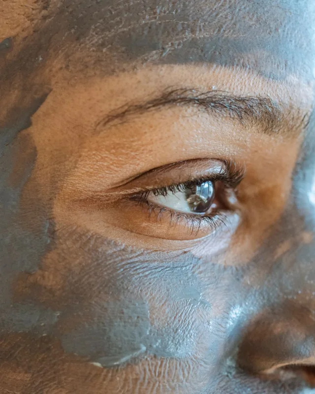 Natural image showing congested, blocked skin
