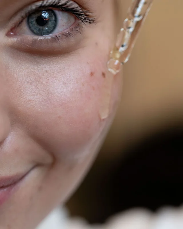Natural image showing dehydrated skin