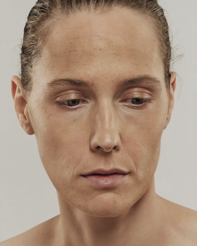 Natural image showing dull, tired skin