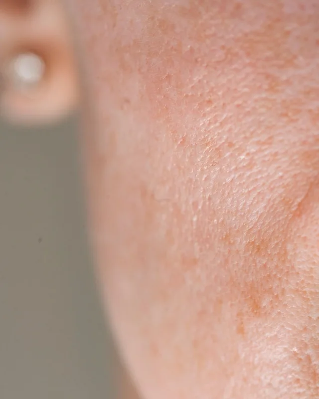 Natural image showing uneven texture
