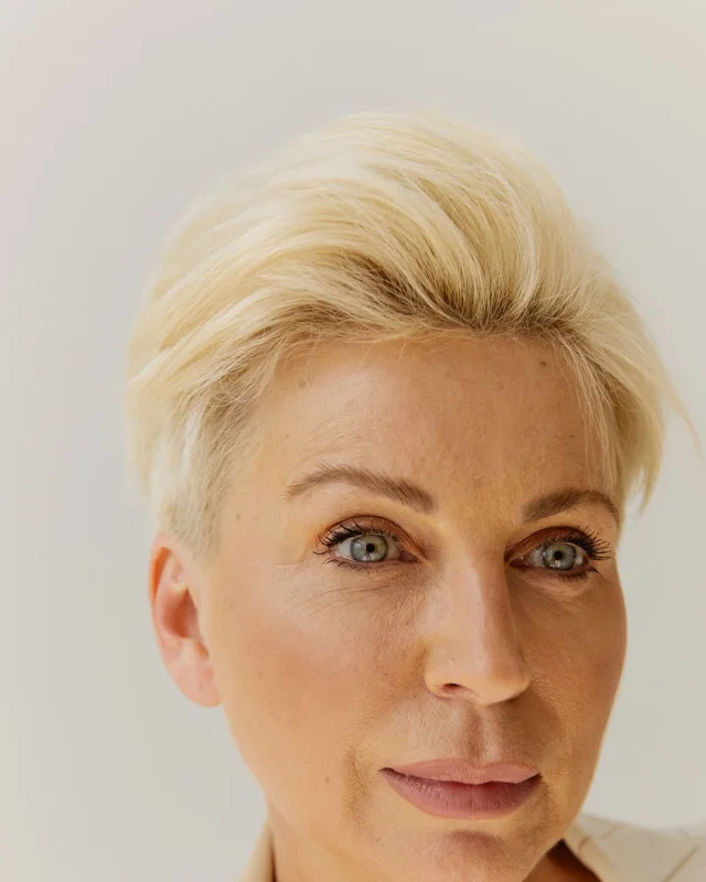 Natural image showing loss of facial firmness