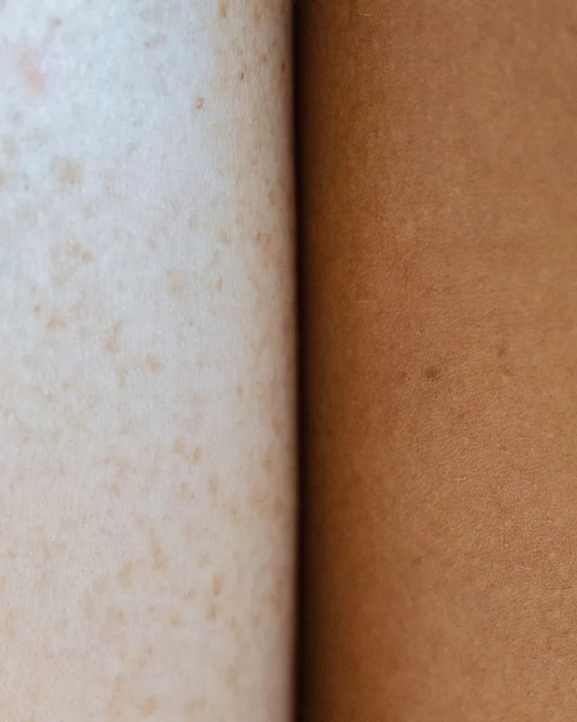 Natural image showing uneven skin tone
