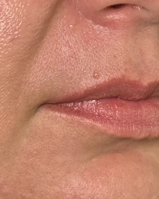 Natural image showing age-related volume loss