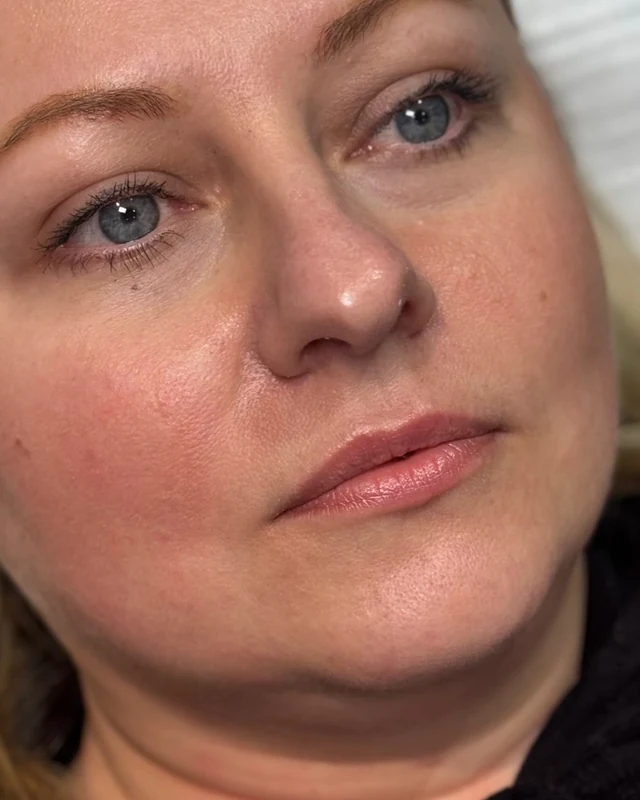 Natural image showing naturally thin lips