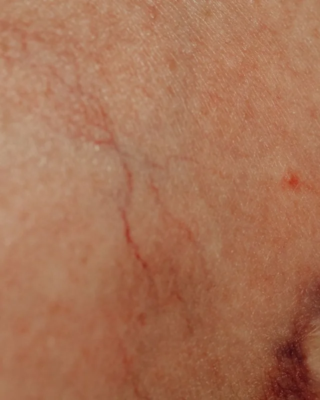 Natural image showing thread veins