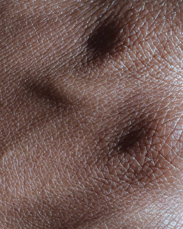 Natural image showing benign skin lesions
