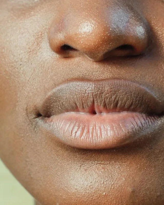 Natural facial skin showing uneven surface texture