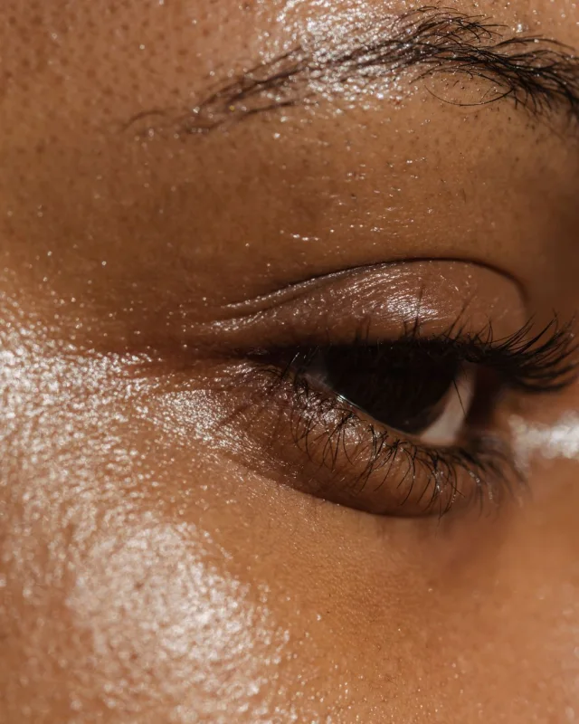 Natural image showing dull skin