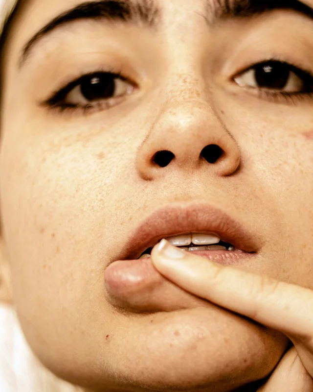 Natural image showing sun damage