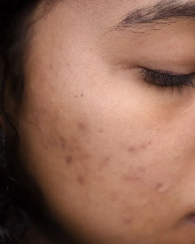 Natural image showing discoloured scars