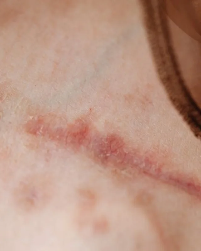 Natural image showing surgical scars